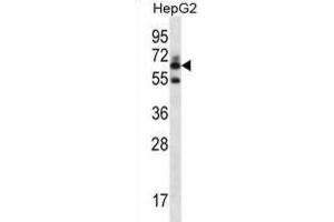 Western Blotting (WB) image for anti-gamma-Glutamyltransferase 2 (gGT2) antibody (ABIN2996985) (gGT2 Antikörper)