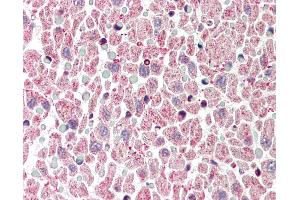 Anti-BCL2L1 / Bcl-x antibody IHC of human heart.