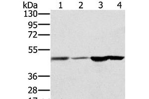 Western Blot analysis of Human fetal brain and normal liver tissue, Human normal kidney tissue and hepg2 cell using RNH1 Polyclonal Antibody at dilution of 1:400 (RNH1 Antikörper)