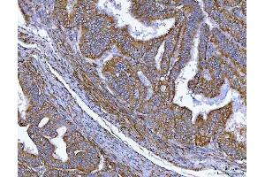 IHC analysis of MIM/MTSS1 using anti-MIM/MTSS1 antibody (ABIN7600276).