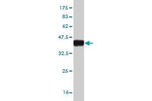 Western Blot detection against Immunogen (37. (ASB10 Antikörper  (AA 48-153))