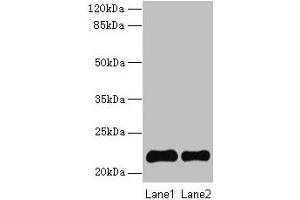 Western blot All lanes: SIRPD antibody at 14 μg/mL Lane 1: 293T whole cell lysate Lane 2: Mouse spleen tissue Secondary Goat polyclonal to rabbit IgG at 1/10000 dilution Predicted band size: 22 kDa Observed band size: 22 kDa (SIRPD Antikörper  (AA 30-197))