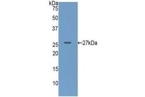 Detection of Recombinant GUSb, Human using Polyclonal Antibody to Glucuronidase Beta (GUSb) (Glucuronidase beta Antikörper  (AA 451-649))