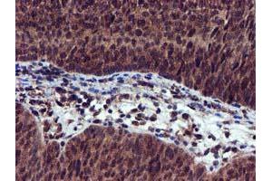 Image no. 7 for anti-EPM2A (Laforin) Interacting Protein 1 (EPM2AIP1) antibody (ABIN1498045) (EPM2AIP1 Antikörper)