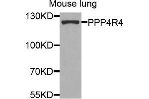 Western blot analysis of extracts of mouse lung cells, using PPP4R4 antibody. (PPP4R4 Antikörper)