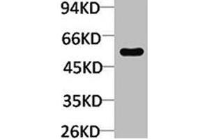 Western blot analysis of Mouse skeletal muscle using TRIM72 Polyclonal Antibody. (TRIM72 Antikörper)