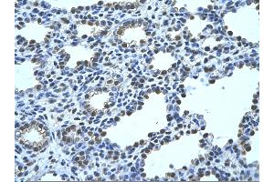 Rabbit Anti-FBP1 Antibody       Paraffin Embedded Tissue:  Human alveolar cell   Cellular Data:  Epithelial cells of renal tubule  Antibody Concentration:   4. (FBP1 Antikörper  (N-Term))