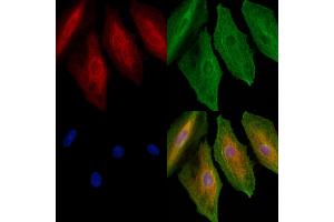 ABIN6259597 and ABIN6275987 staining  cells by IF/ICC.