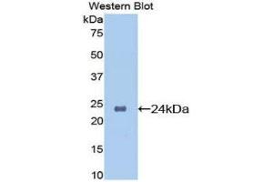 Western Blotting (WB) image for anti-Orosomucoid 1 (ORM1) (AA 19-207) antibody (ABIN3207792) (ORM1 Antikörper  (AA 19-207))