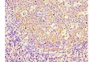 Immunohistochemistry of paraffin-embedded human tonsil tissue using ABIN7158664 at dilution of 1:100 (PBK Antikörper  (AA 1-322))