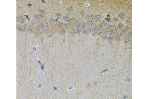 Immunohistochemistry of paraffin-embedded Mouse brain using ERBB3 Polyclonal Antibody at dilution of 1:100 (40x lens). (ERBB3 Antikörper)