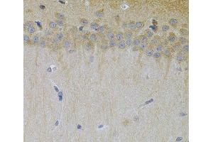 Immunohistochemistry of paraffin-embedded Mouse brain using ERBB3 Polyclonal Antibody at dilution of 1:100 (40x lens).