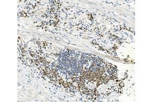 IHC analysis of EEF2 using anti-EEF2 antibody (ABIN7603141). (EEF2 Antikörper  (N-Term))