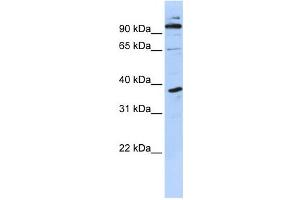 Western Blotting (WB) image for anti-PHD Finger Protein 11 (PHF11) antibody (ABIN2458372) (PHF11 Antikörper)