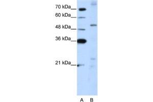 Western Blotting (WB) image for anti-Zinc Finger Protein 596 (ZNF596) antibody (ABIN2462008) (ZNF596 Antikörper)