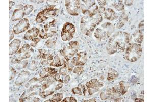 IHC-P Image Immunohistochemical analysis of paraffin-embedded human stomach, using UNC13D, antibody at 1:100 dilution. (UNC13D Antikörper  (C-Term))