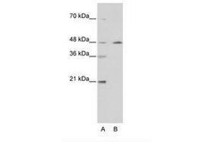 Image no. 2 for anti-Nuclear Receptor Subfamily 2, Group F, Member 2 (NR2F2) (AA 141-190) antibody (ABIN6736209) (NR2F2 Antikörper  (AA 141-190))