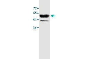 Western blot analysis of human fetal skeletal muscle lysate with ACTL6B polyclonal antibody  at 1 : 500 dilution. (Actin-Like 6B Antikörper  (AA 178-452))