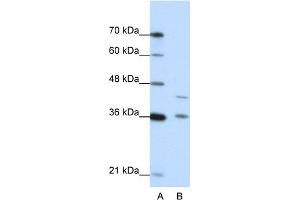 WB Suggested Anti-NKD2 Antibody Titration:  0. (NKD2 Antikörper  (N-Term))