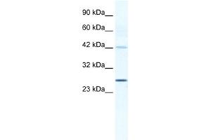 WB Suggested Anti-GJB4 Antibody Titration:  1. (GJB4 Antikörper  (Middle Region))