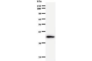 Western Blotting (WB) image for anti-General Transcription Factor IIA, 1, 19/37kDa (GTF2A1) antibody (ABIN931060) (GTF2A1 Antikörper)