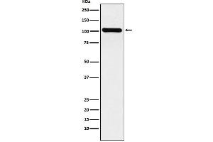 Western blot analysis of BACH1/BRIP1 expression in HeLa cell lysate.