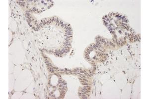 Immunohistochemistry (IHC) image for anti-Lysine (K)-Specific Demethylase 4A (KDM4A) (AA 350-400) antibody (ABIN7448617)