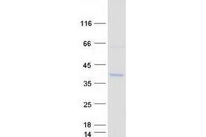 Validation with Western Blot