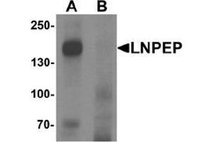 Western blot analysis of LNPEP in human lung tissue lysate with LNPEP Antibody  at 1 ug/mL in (A) the absence and (B) the presence of blocking peptide.