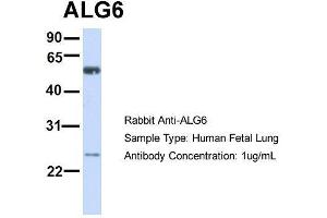 Host:  Rabbit  Target Name:  ALG6  Sample Type:  Human Fetal Lung  Antibody Dilution:  1. (ALG6 Antikörper  (N-Term))