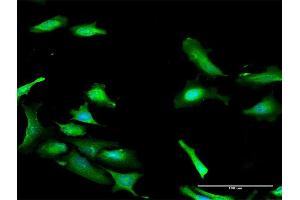 Immunofluorescence of purified MaxPab antibody to PDCD2 on HeLa cell.
