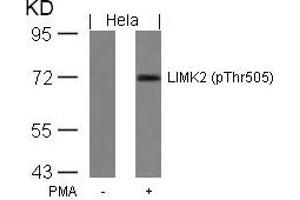 Western blot analysis of extracts from Hela cells untreated or treated with PMA using LIMK2(Phospho-Thr505) Antibody. (LIMK2 Antikörper  (pThr505))