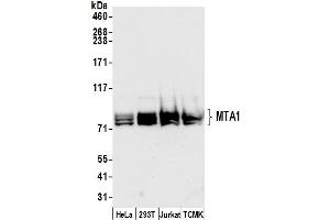 Western Blotting (WB) image for anti-Metastasis Associated 1 (MTA1) (C-Term) antibody (ABIN7454687)