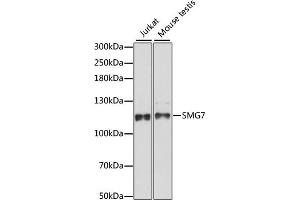 Western blot analysis of extracts of various cell lines, using SMG7 antibody (ABIN7270376) at 1:1000 dilution. (SMG7 Antikörper  (AA 1-300))