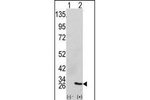 Western blot analysis of GRB2 (arrow) using GRB2 Antibody (Center) (ABIN390238 and ABIN2840708). (GRB2 Antikörper  (AA 89-118))