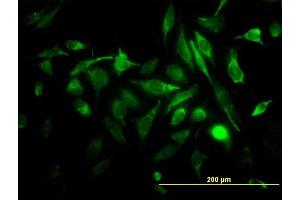 Immunofluorescence of monoclonal antibody to RAB3B on HeLa cell. (RAB3B Antikörper  (AA 120-219))