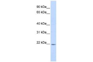 PPIB antibody used at 1 ug/ml to detect target protein. (PPIB Antikörper)