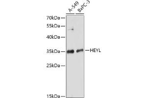 Western blot analysis of extracts of various cell lines, using HEYL antibody (ABIN7267563) at 1:1000 dilution. (HEYL Antikörper  (AA 129-328))