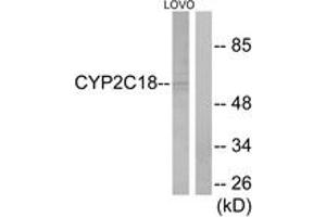 Western blot analysis of extracts from LOVO cells, using Cytochrome P450 2C8/9/18/19 Antibody. (Cytochrome P450 2C8/9/18/19 (AA 111-160) Antikörper)