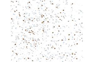 Immunocytochemistry (ICC) image for anti-Forkhead Box M1 (FOXM1) (AA 650-700) antibody (ABIN7795806)