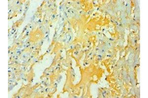 Immunohistochemistry (IHC) image for anti-Wingless-Type MMTV Integration Site Family Member 2 (WNT2) (AA 26-360) antibody (ABIN7166295)