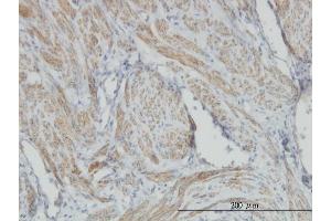 Immunoperoxidase of monoclonal antibody to ACTB on formalin-fixed paraffin-embedded human smooth muscle. (beta Actin Antikörper  (AA 1-375))