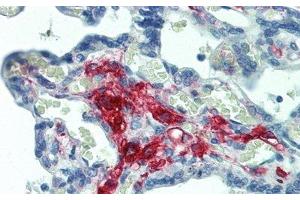 Detection of FE in Human Placenta Tissue using Polyclonal Antibody to Ferritin (FE) (Ferritin Antikörper)