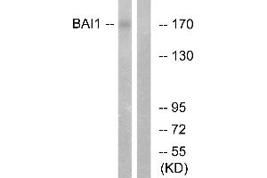 Immunohistochemistry analysis of paraffin-embedded human brain tissue using BAI1 antibody. (BAI1 Antikörper  (Internal Region))