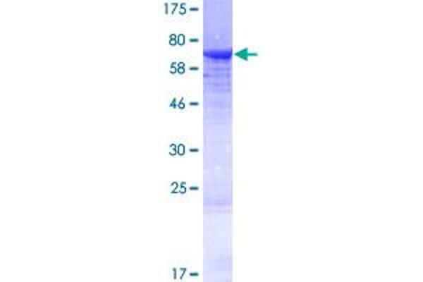 Keratin 25 Protein (KRT25) (AA 1-450) (GST tag)