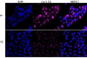 anti-Cyclin E2 (CCNE2) antibody