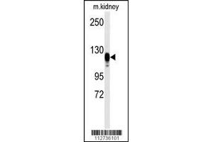 Western blot analysis of anti-EGFR Antibody (S1070) in kidney heart tissue lysates (35ug/lane) (EGF Antikörper  (AA 1048-1077))