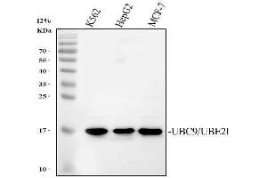 Western blot analysis of UBE2I/UBC9 using anti-UBE2I/UBC9 antibody (ABIN3042573).
