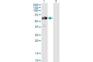 Western Blotting (WB) image for anti-Aldehyde Dehydrogenase 4 Family, Member A1 (ALDH4A1) (AA 1-564) antibody (ABIN599053) (ALDH4A1 Antikörper  (AA 1-564))