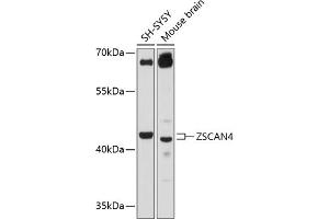 Western blot analysis of extracts of various cell lines, using ZSC antibody (ABIN6133026, ABIN6150544, ABIN6150546 and ABIN6215572) at 1:3000 dilution. (ZSCAN4 Antikörper  (AA 1-310))